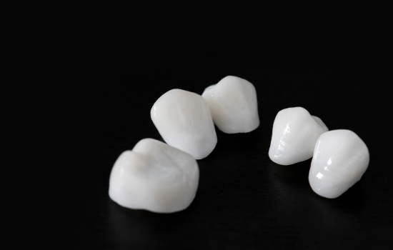 Five metal free dental restorations against black background
