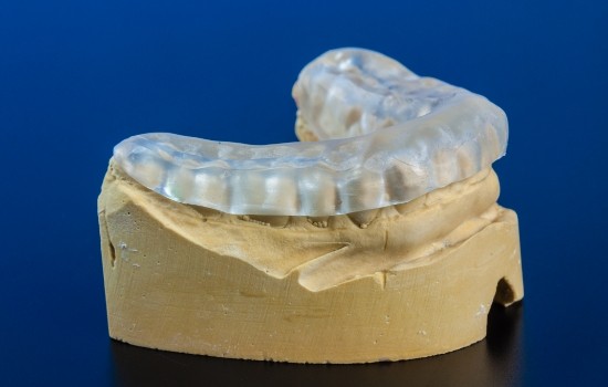 Clear nightguard resting on model of a row of teeth