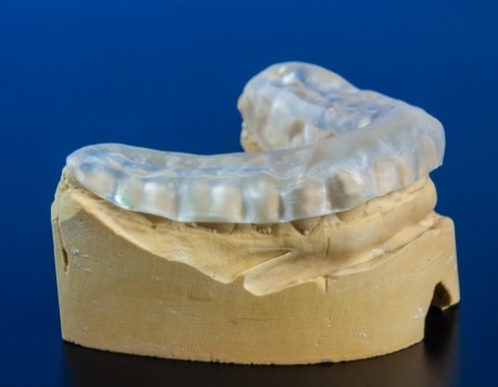 Occlusal splint on model of the teeth