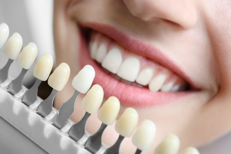 A woman comparing the shades of her teeth